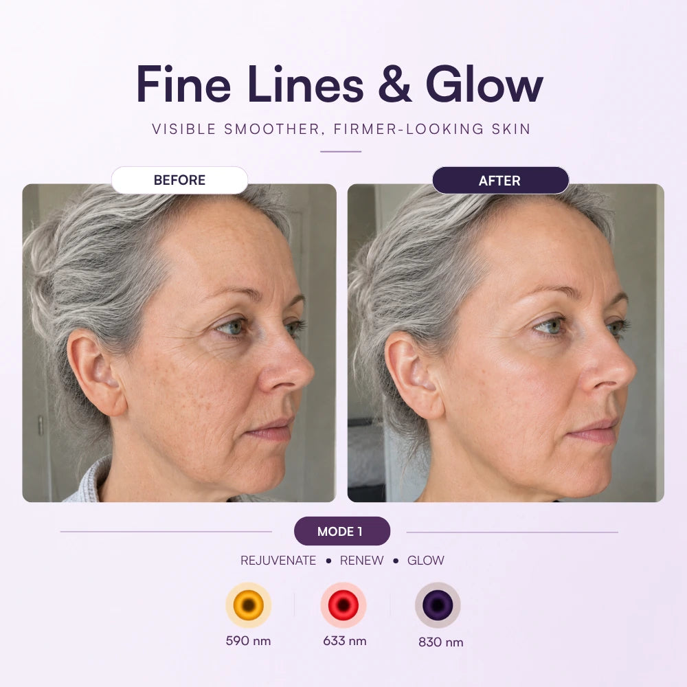 Koanna® MultiGlo™ LED Light Therapy Mask